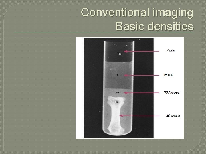 Conventional imaging Basic densities 