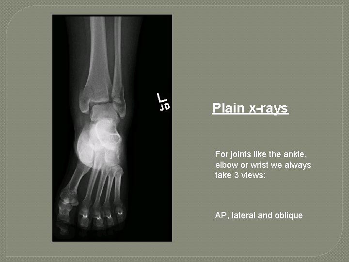 Plain x-rays For joints like the ankle, elbow or wrist we always take 3