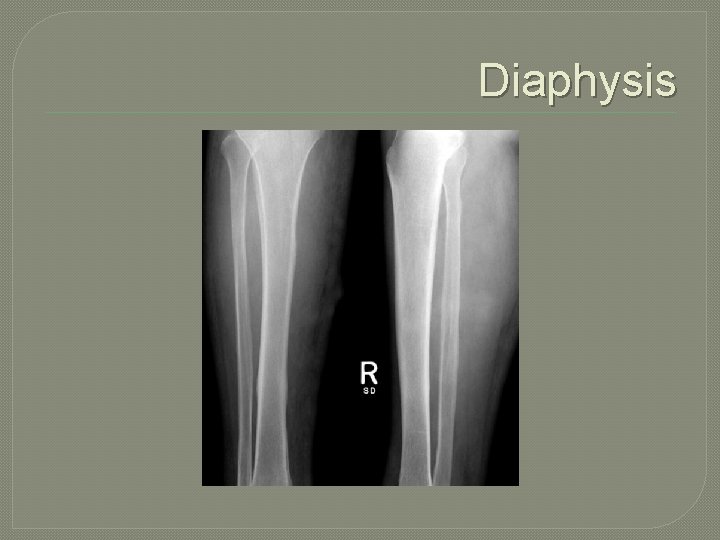 Diaphysis 