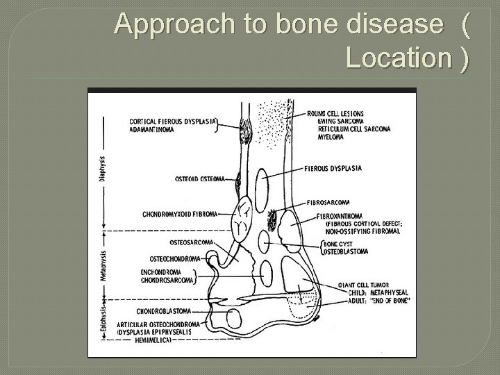 Approach to bone disease ( Location ) 