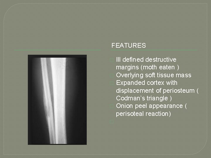 FEATURES � � � Ill defined destructive margins (moth eaten ) Overlying soft tissue