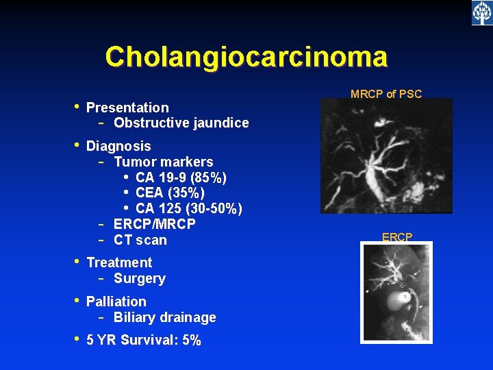 Cholangiocarcinoma • Presentation - Obstructive jaundice • Diagnosis - Tumor markers • CA 19
