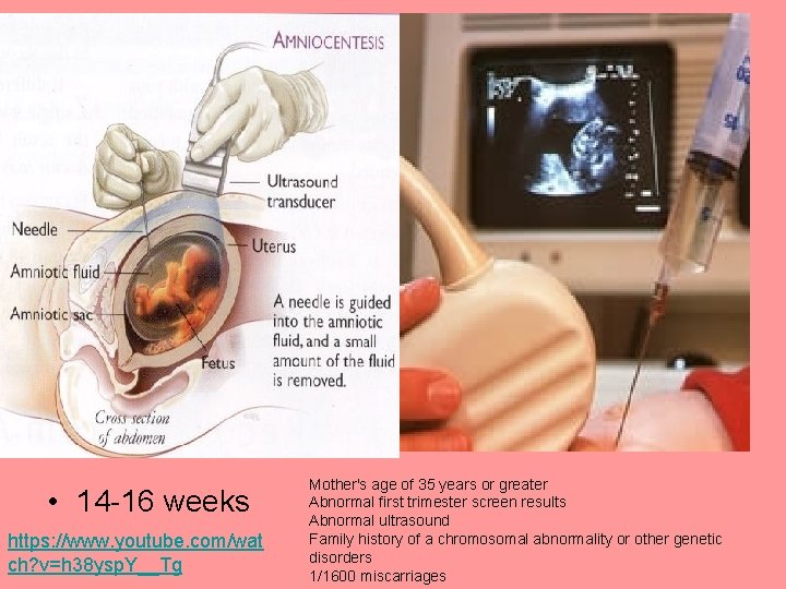 hhh • 14 -16 weeks https: //www. youtube. com/wat ch? v=h 38 ysp. Y__Tg