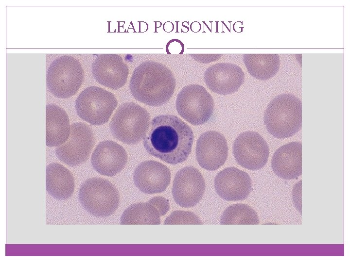 LEAD POISONING 