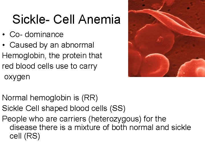 Sickle- Cell Anemia • Co- dominance • Caused by an abnormal Hemoglobin, the protein