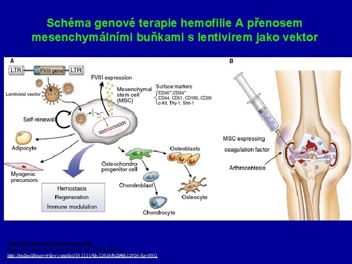 Schéma genové terapie hemofilie A přenosem mesenchymálními buňkami s lentivirem jako vektor Journal of