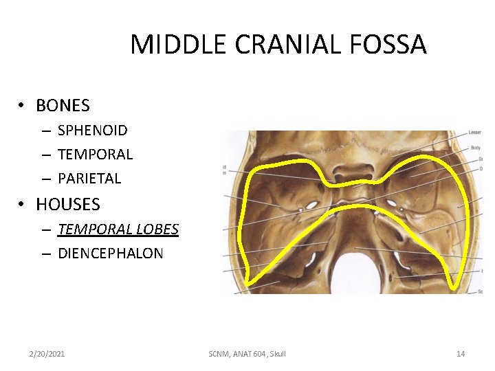 MIDDLE CRANIAL FOSSA • BONES – SPHENOID – TEMPORAL – PARIETAL • HOUSES –