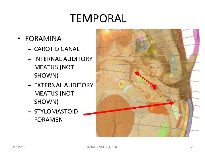 TEMPORAL • FORAMINA – CAROTID CANAL – INTERNAL AUDITORY MEATUS (NOT SHOWN) – EXTERNAL