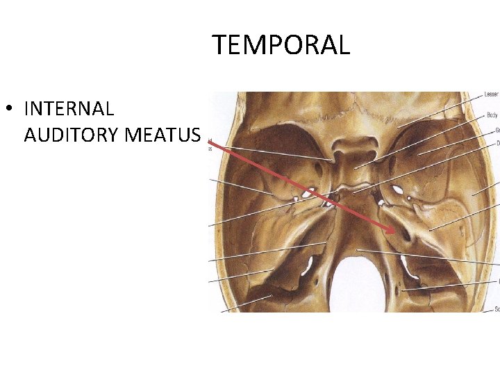 TEMPORAL • INTERNAL AUDITORY MEATUS 