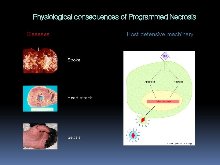 Physiological consequences of Programmed Necrosis Diseases Host defensive machinery Stroke Heart attack Sepsis 