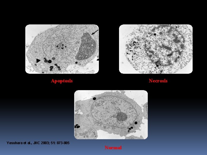 Apoptosis Yasuhara et al. , JHC 2003; 51: 873 -885 Necrosis Normal 