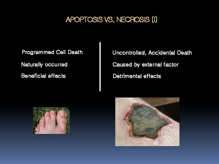 APOPTOSIS VS. NECROSIS (I) Programmed Cell Death Uncontrolled, Accidental Death Naturally occurred Caused by