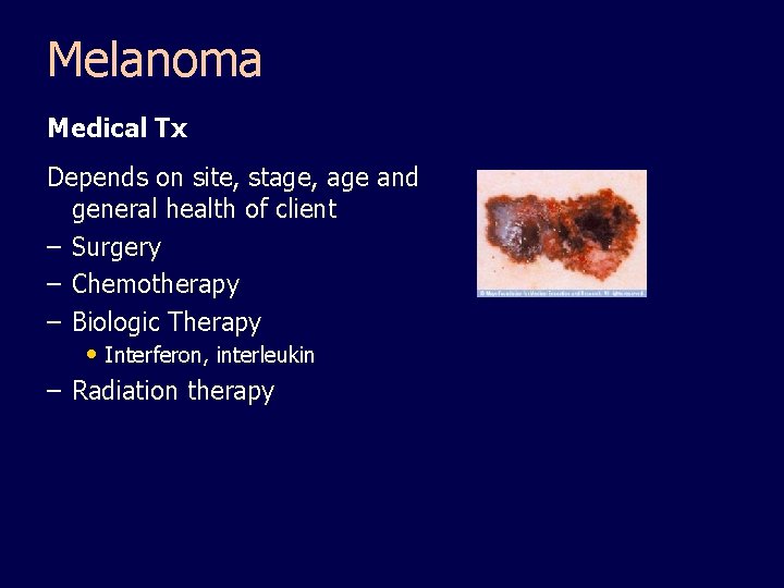 Melanoma Medical Tx Depends on site, stage, age and general health of client –