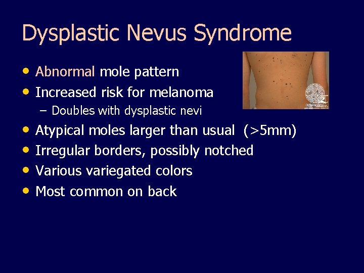 Dysplastic Nevus Syndrome • Abnormal mole pattern • Increased risk for melanoma – Doubles