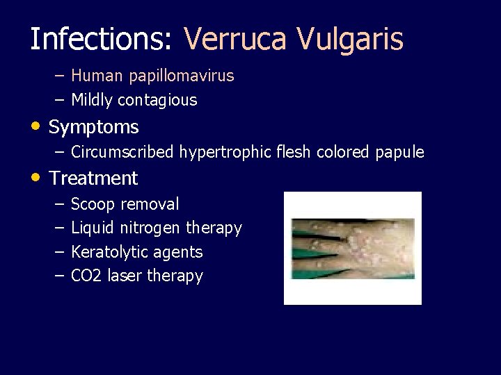 Infections: Verruca Vulgaris – Human papillomavirus – Mildly contagious • Symptoms – Circumscribed hypertrophic