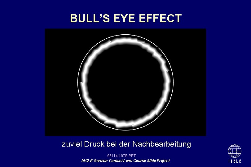 BULL’S EYE EFFECT zuviel Druck bei der Nachbearbeitung 96114 -107 S. PPT IACLE German
