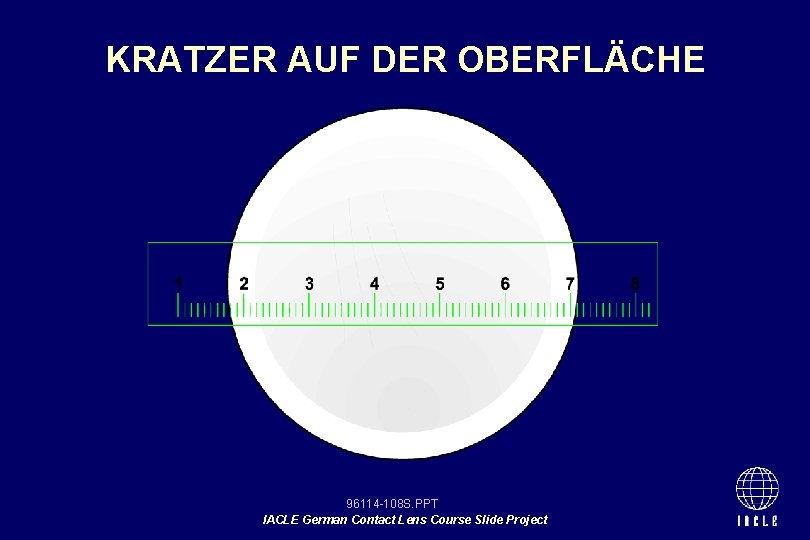 KRATZER AUF DER OBERFLÄCHE 96114 -108 S. PPT IACLE German Contact Lens Course Slide