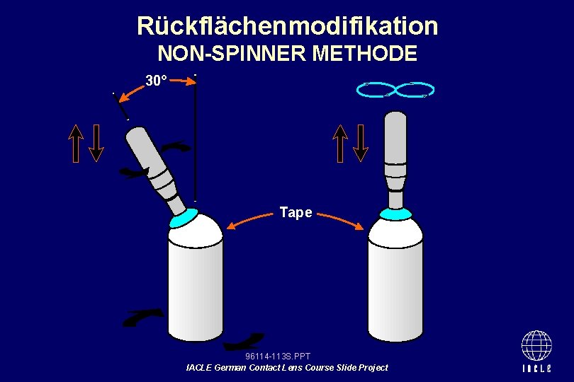 Rückflächenmodifikation NON-SPINNER METHODE 30° Tape 96114 -113 S. PPT IACLE German Contact Lens Course