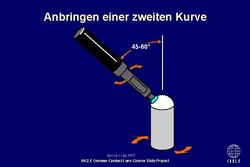 Anbringen einer zweiten Kurve 45 -60° 96114 -114 S. PPT IACLE German Contact Lens