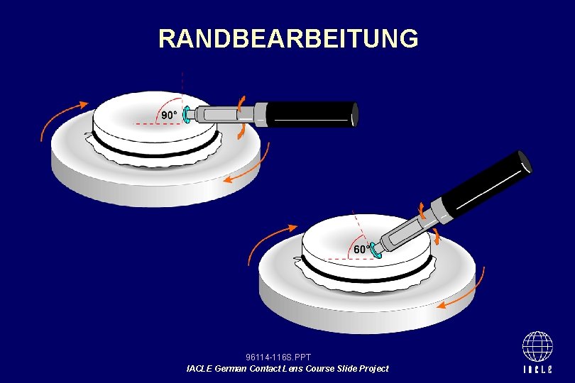 RANDBEARBEITUNG 96114 -116 S. PPT IACLE German Contact Lens Course Slide Project 