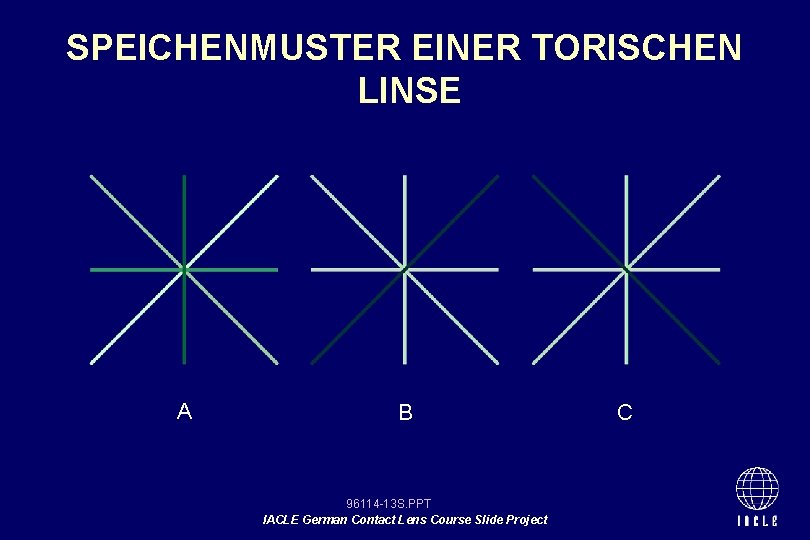 SPEICHENMUSTER EINER TORISCHEN LINSE A B 96114 -13 S. PPT IACLE German Contact Lens