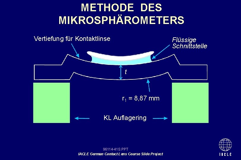 METHODE DES MIKROSPHÄROMETERS Vertiefung für Kontaktlinse Flüssige Schnittstelle t r 1 = 8, 87