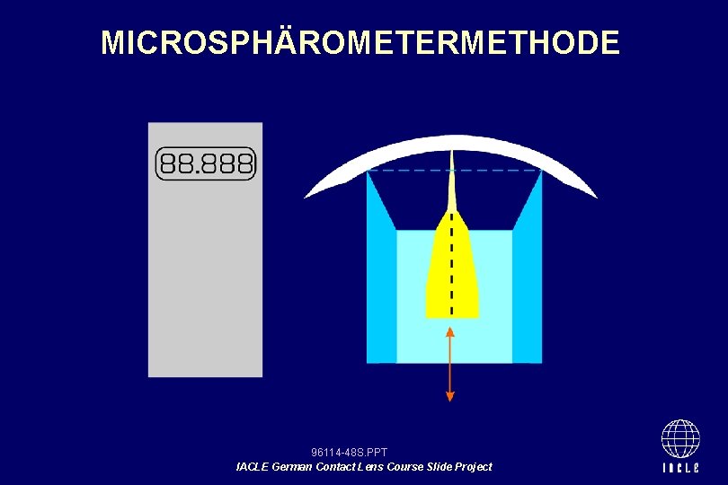 MICROSPHÄROMETERMETHODE 96114 -48 S. PPT IACLE German Contact Lens Course Slide Project 