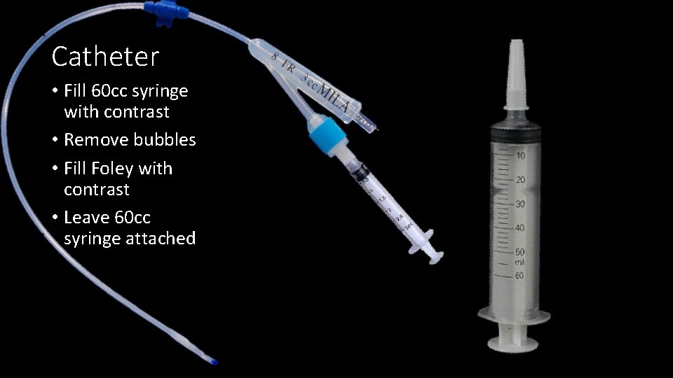 Catheter • Fill 60 cc syringe with contrast • Remove bubbles • Fill Foley
