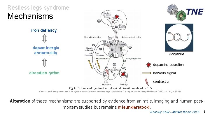 Restless legs syndrome Mechanisms iron defiency dopaminergic abnormality dopamine secretion circadian rythm nervous signal