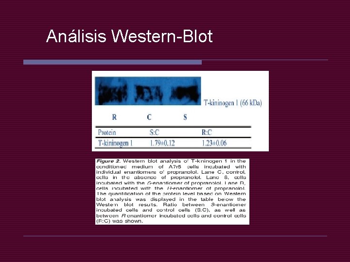 Análisis Western-Blot 