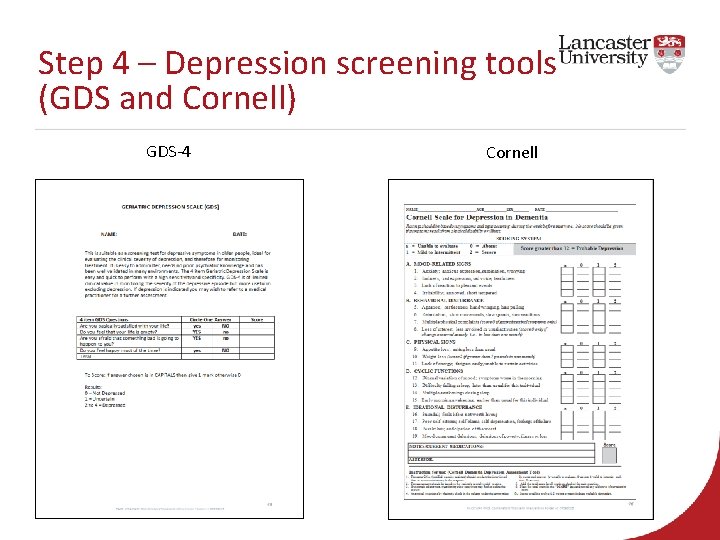 Step 4 – Depression screening tools (GDS and Cornell) GDS-4 Cornell 