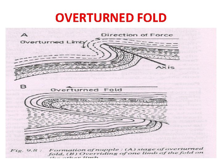 OVERTURNED FOLD 