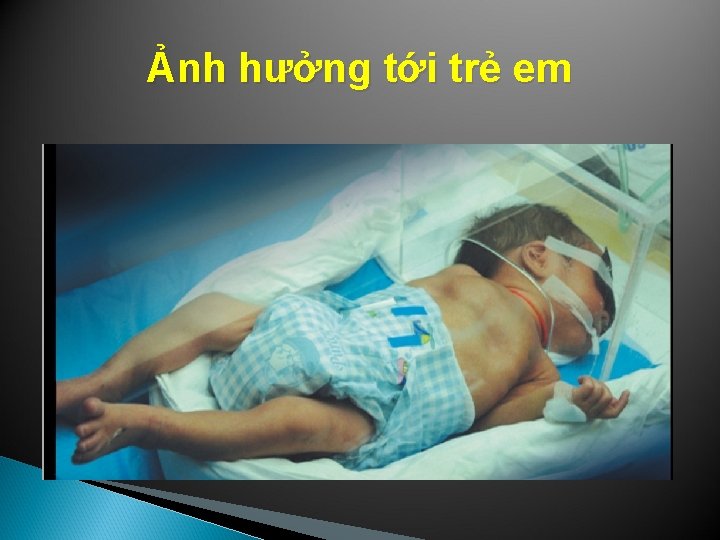 Ảnh hưởng tới trẻ em 