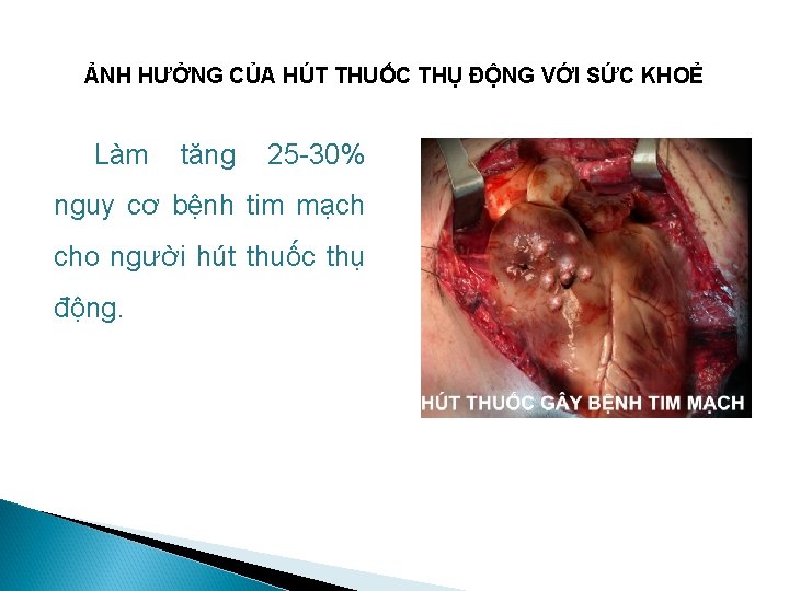 ẢNH HƯỞNG CỦA HÚT THUỐC THỤ ĐỘNG VỚI SỨC KHOẺ Làm tăng 25 -30%