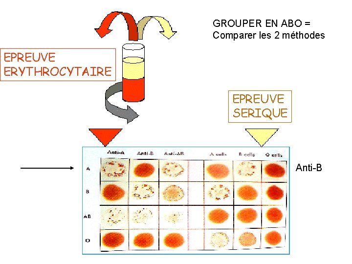 GROUPER EN ABO = Comparer les 2 méthodes EPREUVE ERYTHROCYTAIRE EPREUVE SERIQUE Anti-B 