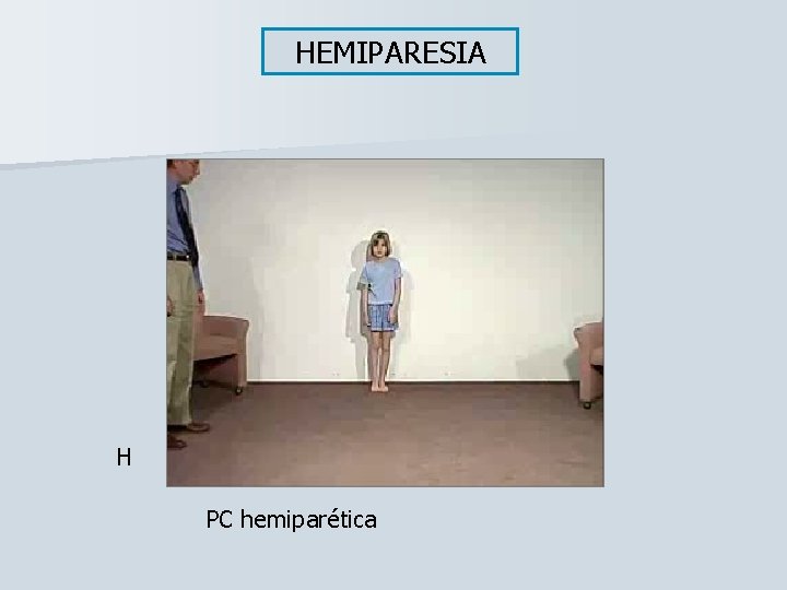 HEMIPARESIA H PC hemiparética 