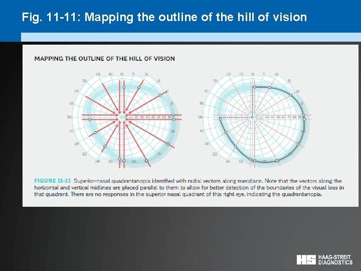 Fig. 11 -11: Mapping the outline of the hill of vision 