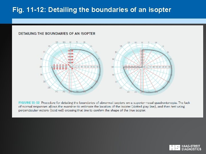 Fig. 11 -12: Detailing the boundaries of an isopter 