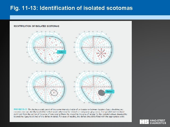 Fig. 11 -13: Identification of isolated scotomas 