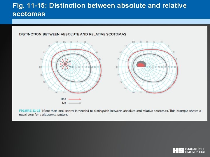 Fig. 11 -15: Distinction between absolute and relative scotomas 