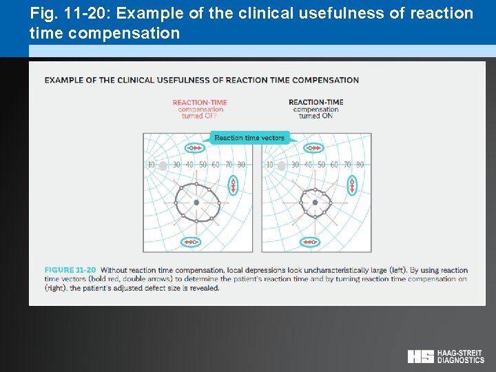 Fig. 11 -20: Example of the clinical usefulness of reaction time compensation 