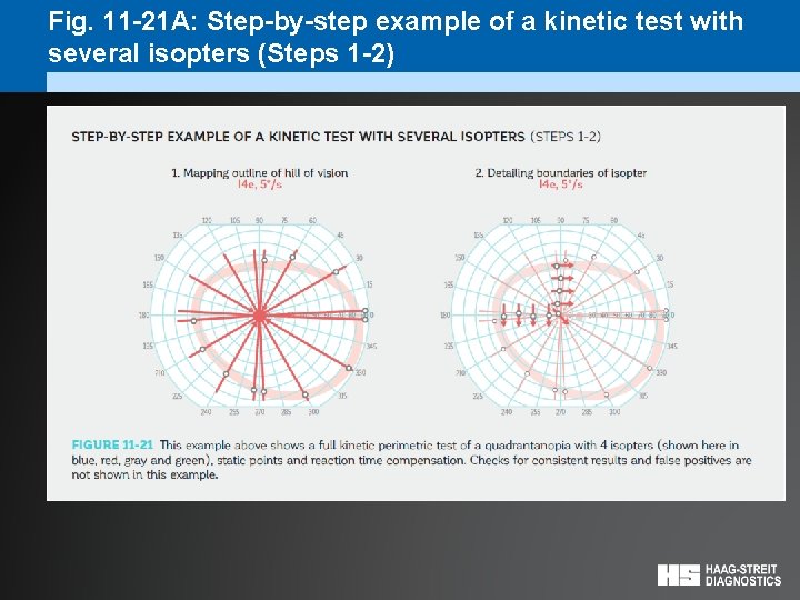 Fig. 11 -21 A: Step-by-step example of a kinetic test with several isopters (Steps