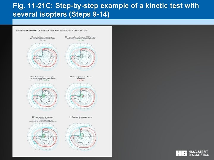 Fig. 11 -21 C: Step-by-step example of a kinetic test with several isopters (Steps