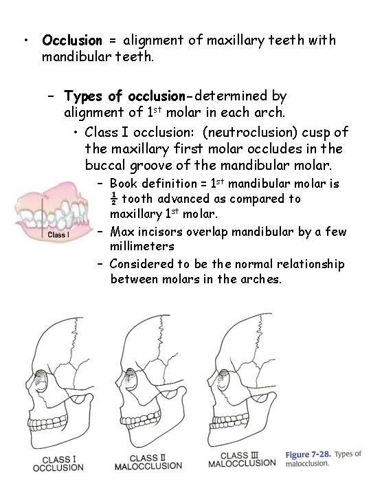  • Occlusion = alignment of maxillary teeth with mandibular teeth. – Types of