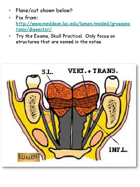  • Plane/cut shown below? • Pix from: • http: //www. meddean. luc. edu/lumen/meded/grossana