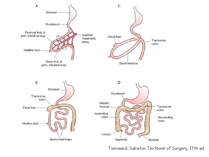 Townsend: Sabiston Textbook of Surgery, 17 th ed 
