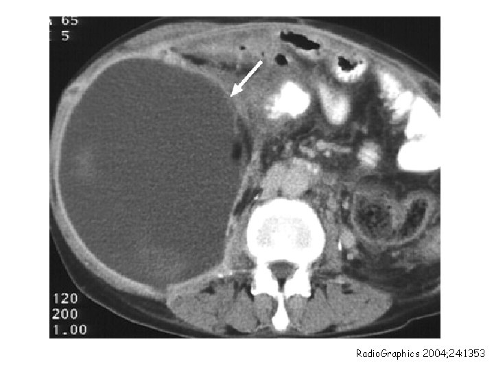Radio. Graphics 2004; 24: 1353 
