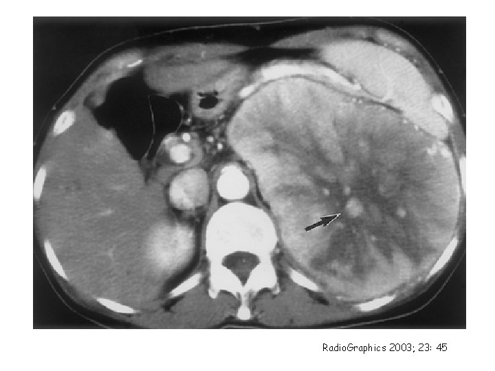 Radio. Graphics 2003; 23: 45 