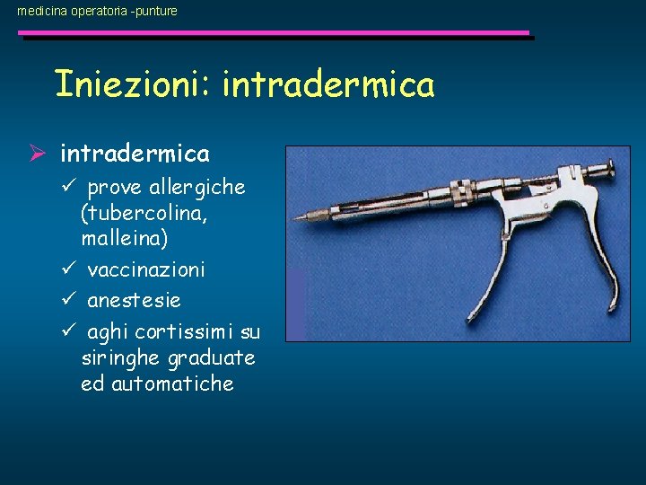 medicina operatoria -punture Iniezioni: intradermica Ø intradermica ü prove allergiche (tubercolina, malleina) ü vaccinazioni