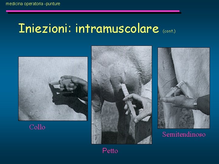 medicina operatoria -punture Iniezioni: intramuscolare Collo (cont. ) Semitendinoso Petto 